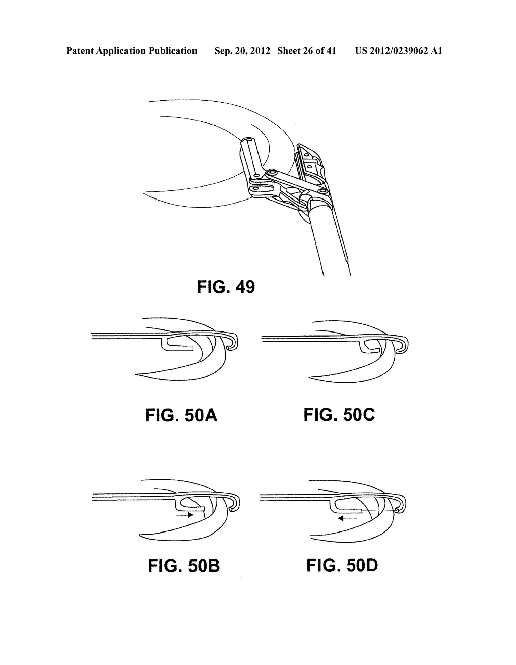 METHODS OF MENISCUS REPAIR - diagram, schematic, and image 27