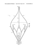 DEVICE AND METHOD FOR REMOVING MATERIAL FROM A HOLLOW ANATOMICAL STRUCTURE diagram and image