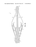 DEVICE AND METHOD FOR REMOVING MATERIAL FROM A HOLLOW ANATOMICAL STRUCTURE diagram and image