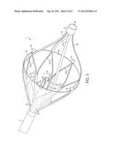 DEVICE AND METHOD FOR REMOVING MATERIAL FROM A HOLLOW ANATOMICAL STRUCTURE diagram and image