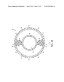 DEVICE AND METHOD FOR REMOVING MATERIAL FROM A HOLLOW ANATOMICAL STRUCTURE diagram and image