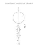 DEVICE AND METHOD FOR REMOVING MATERIAL FROM A HOLLOW ANATOMICAL STRUCTURE diagram and image