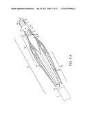 DEVICE AND METHOD FOR REMOVING MATERIAL FROM A HOLLOW ANATOMICAL STRUCTURE diagram and image