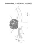 DEVICES AND METHODS FOR THE TREATMENT OF VASCULAR DEFECTS diagram and image