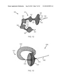 DEVICES AND METHODS FOR THE TREATMENT OF VASCULAR DEFECTS diagram and image