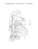 TISSUE MANIPULATION DEVICES diagram and image