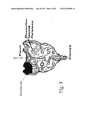 SPINAL MOTION PRESERVATION DEVICES AND METHODS OF USE diagram and image