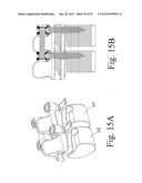 SPINAL MOTION PRESERVATION DEVICES AND METHODS OF USE diagram and image