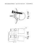 SPINAL MOTION PRESERVATION DEVICES AND METHODS OF USE diagram and image