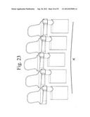 SPINAL MOTION PRESERVATION DEVICES AND METHODS OF USE diagram and image