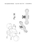 SPINAL MOTION PRESERVATION DEVICES AND METHODS OF USE diagram and image