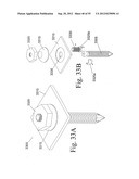 SPINAL MOTION PRESERVATION DEVICES AND METHODS OF USE diagram and image