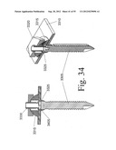 SPINAL MOTION PRESERVATION DEVICES AND METHODS OF USE diagram and image