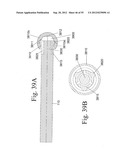 SPINAL MOTION PRESERVATION DEVICES AND METHODS OF USE diagram and image