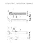 SPINAL MOTION PRESERVATION DEVICES AND METHODS OF USE diagram and image