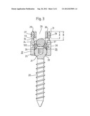 ANCHORING ELEMENT FOR USE IN SPINE OR BONE SURGERY, METHODS FOR USE AND     PRODUCTION THEREOF diagram and image