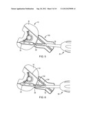 SYSTEM AND METHOD FOR BONE ANCHOR REMOVAL diagram and image