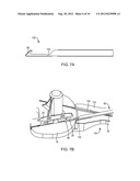 SYSTEM AND METHOD FOR BONE ANCHOR REMOVAL diagram and image