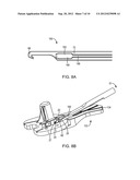 SYSTEM AND METHOD FOR BONE ANCHOR REMOVAL diagram and image