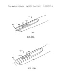 SYSTEM AND METHOD FOR BONE ANCHOR REMOVAL diagram and image