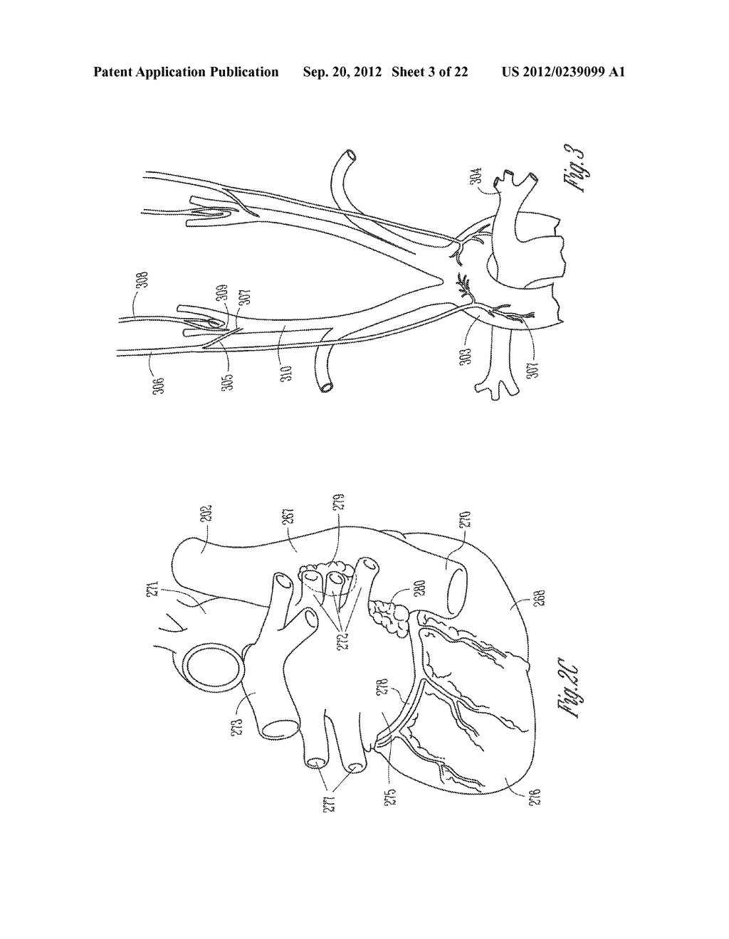 SYSTEM AND METHOD FOR DELIVERING MYOCARDIAL AND AUTONOMIC NEURAL     STIMULATION - diagram, schematic, and image 04