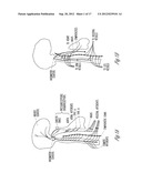 SYSTEM AND METHOD FOR FILTERING NEURAL STIMULATION diagram and image