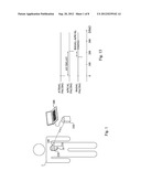 IMPLANTABLE MEDICAL DEVICE FOR CARDIAC THERAPY diagram and image