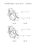 IMPLANTABLE MEDICAL DEVICE FOR CARDIAC THERAPY diagram and image