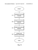 IMPLANTABLE MEDICAL DEVICE FOR CARDIAC THERAPY diagram and image