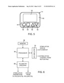 NEUROSTIMULATION SYSTEM FOR MATCHING IDEAL POLE SPACING WITH EFFECTIVE     ELECTRODE SEPARATION diagram and image