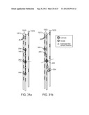 NEUROSTIMULATION SYSTEM FOR MATCHING IDEAL POLE SPACING WITH EFFECTIVE     ELECTRODE SEPARATION diagram and image