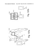 WIRELESS ENERGY TRANSFER WITH  RESONATOR ARRAYS FOR MEDICAL APPLICATIONS diagram and image