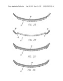 Visual Prosthesis Including a Flexible Circuit Electrode Array diagram and image