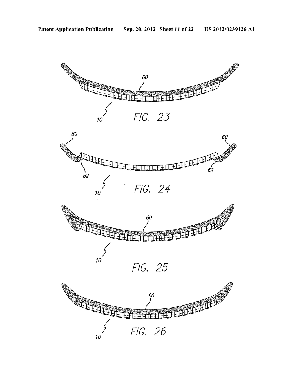 Visual Prosthesis Including a Flexible Circuit Electrode Array - diagram, schematic, and image 12