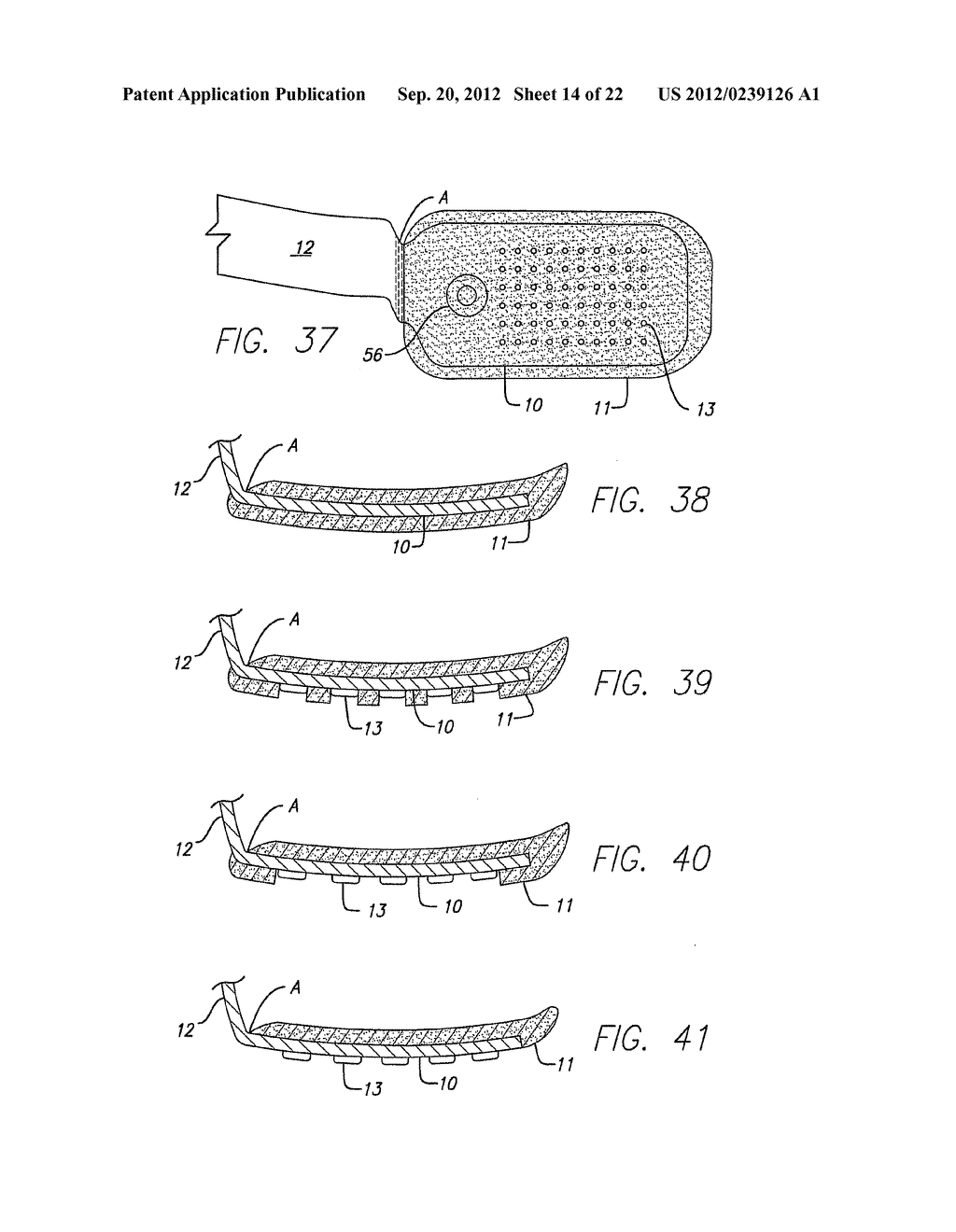 Visual Prosthesis Including a Flexible Circuit Electrode Array - diagram, schematic, and image 15