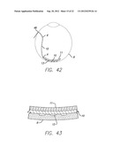 Visual Prosthesis Including a Flexible Circuit Electrode Array diagram and image