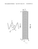 APPARATUS AND METHODS TO ENHANCE BONDING IN ENDOLUMINAL PROSTHESES diagram and image