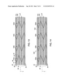 APPARATUS AND METHODS TO ENHANCE BONDING IN ENDOLUMINAL PROSTHESES diagram and image