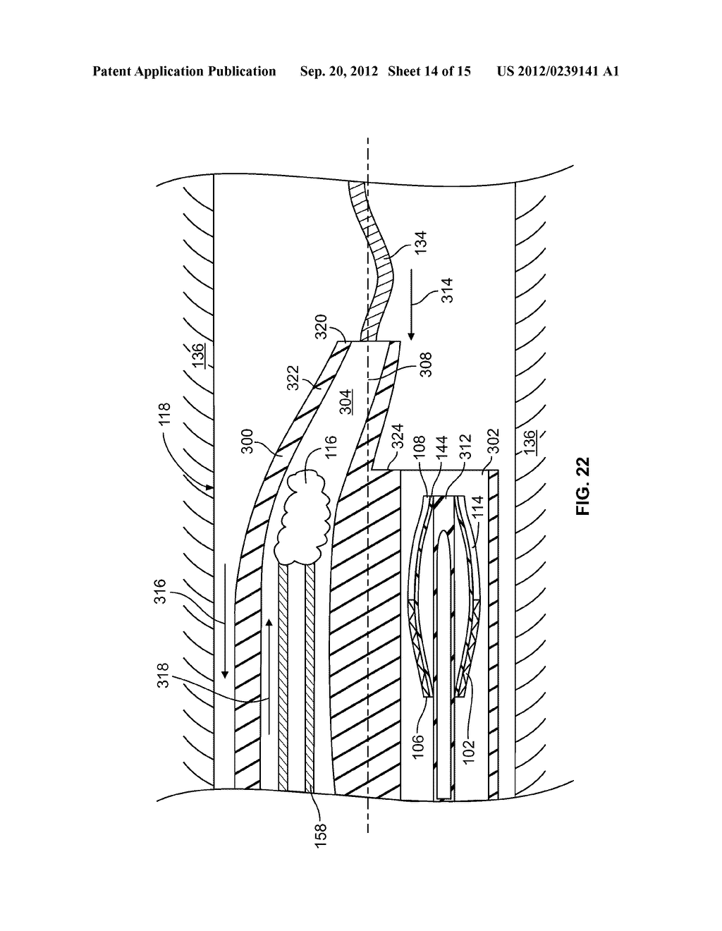 TRANSLUMINAL CARDIAC BALL VALVE AND METHOD FOR DEPLOYMENT THEREOF - diagram, schematic, and image 15