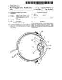 Aberration-Correcting Vision Prosthesis diagram and image