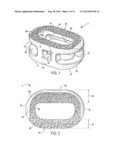 Friction Fit and Vertebral Endplate-Preserving Spinal Implant diagram and image