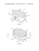 Friction Fit and Vertebral Endplate-Preserving Spinal Implant diagram and image