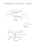 Friction Fit and Vertebral Endplate-Preserving Spinal Implant diagram and image