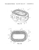 ENDPLATE-PRESERVING SPINAL IMPLANT HAVING A RAISED EXPULSION-RESISTANT     EDGE diagram and image