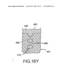 ENDPLATE-PRESERVING SPINAL IMPLANT HAVING A RAISED EXPULSION-RESISTANT     EDGE diagram and image