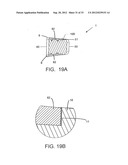 ENDPLATE-PRESERVING SPINAL IMPLANT HAVING A RAISED EXPULSION-RESISTANT     EDGE diagram and image