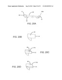 ENDPLATE-PRESERVING SPINAL IMPLANT HAVING A RAISED EXPULSION-RESISTANT     EDGE diagram and image