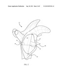 REVISION GLENOID DEVICE AND METHOD diagram and image