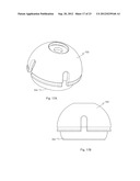 MODULAR TRIAL HEADS FOR A PROSTHETIC diagram and image