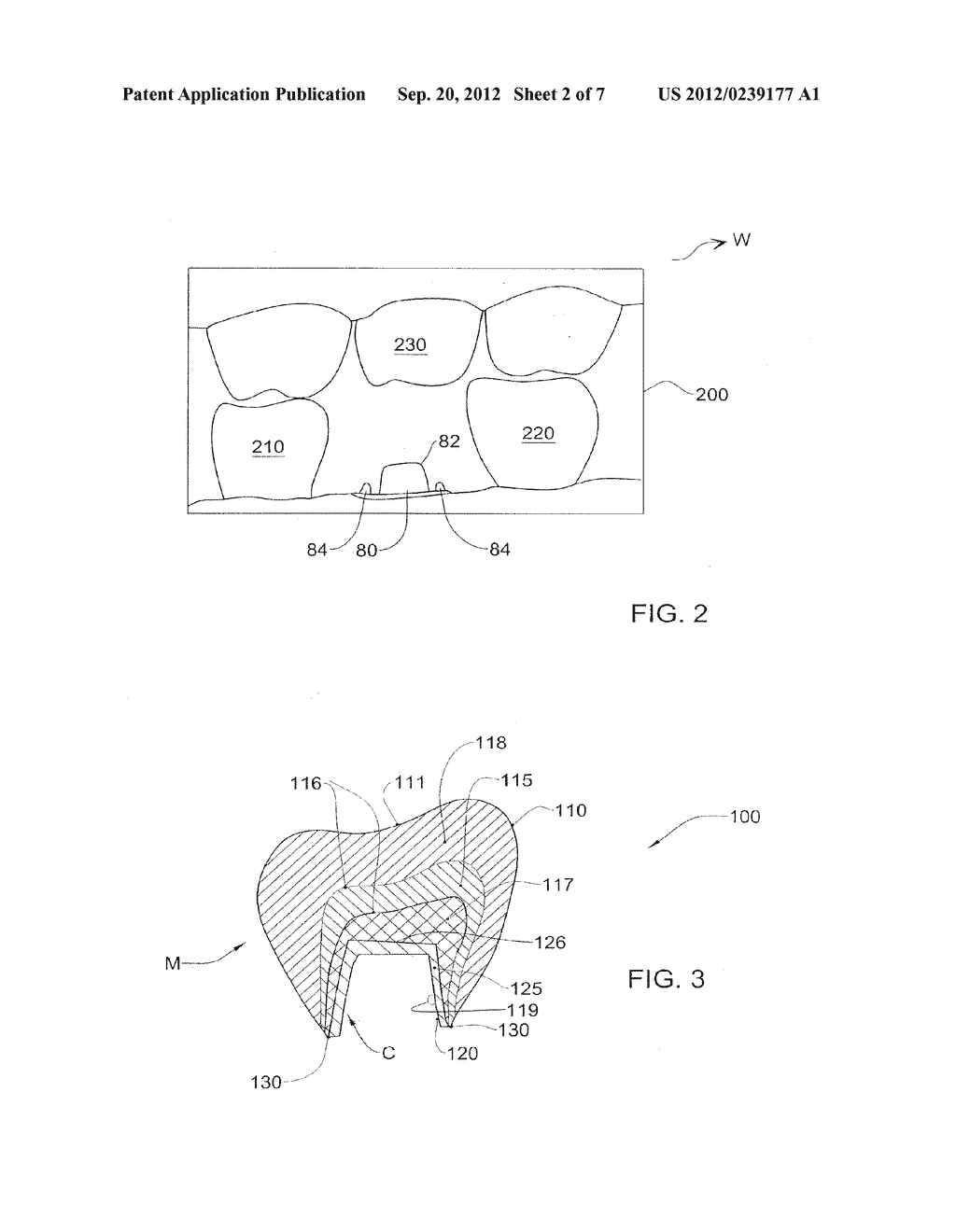 METHOD AND SYSTEM FOR DESIGNING AND PRODUCING DENTAL PROSTHESES AND     APPLIANCES - diagram, schematic, and image 03